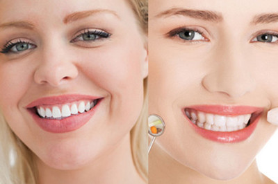 【图】牙线会让牙缝变大吗 那是因为你的姿势不正确
