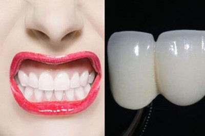 【图】烤瓷牙的寿命是多少 其实你的牙齿很脆弱_烤瓷牙_伊秀美容网|yxlady.com