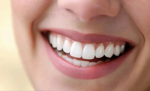关于牙齿美白,你最关心的十个问题都在这里