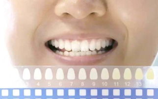 你知道比冷光美白更有效的牙齿美白技术吗