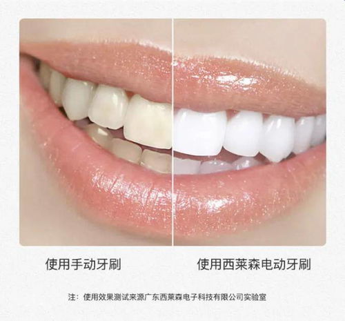这样刷牙,牙齿更美白,口腔更健康