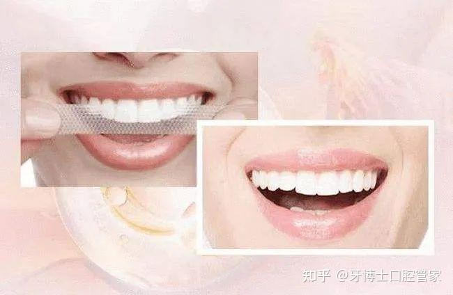 深圳3d美牙贴面怎么收费|医生|牙齿|美容|深圳市_网易订阅
